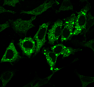2003 HeLa cells.png